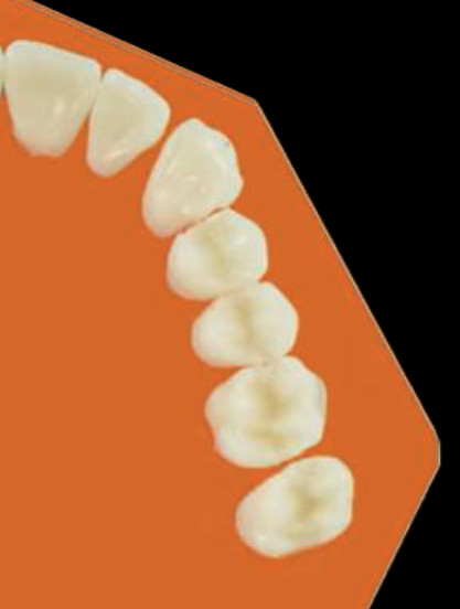 <p>6124753</p><p>(1M, Ci, Li, 1PM, 2M, 2PM, C) </p><p>(2nd molar before the canine is bad; when we see 2nd molars erupting before the 2nd premolar it encroaches on the space of the 2nd premolar)</p>