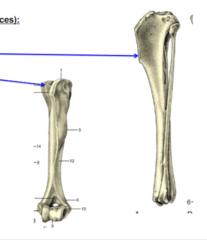 <p>Bone elevations</p><p>What is the BOTTOM blue arrow pointing to?</p>