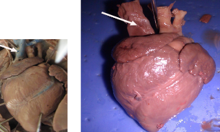 <p>carries blood back to the right atrium</p>
