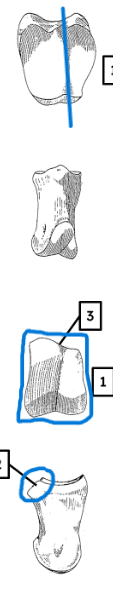 <ul><li><p>asymmetrical</p></li><li><p>ridge</p></li><li><p>distal end roughly rectangular</p></li><li><p>undercut</p></li></ul><p></p><p>sheep intermediate phalanx </p><p></p>
