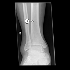 <p>1?</p>