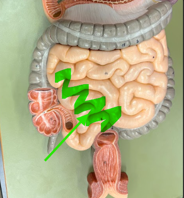 <p>What is the arrow pointing at?</p>