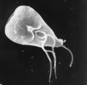 <p>The classic history for __________________ infection is a <strong>camper/hiker </strong>that <strong>drank unfiltered water from a river/stream. </strong>The most common presentation is <span style="color: rgb(100, 124, 44);"><strong><em>foul-smelling steatorrhea</em></strong><em>. </em></span></p>