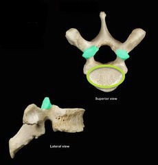 <p>What is the indicated part and vertebrae?</p>