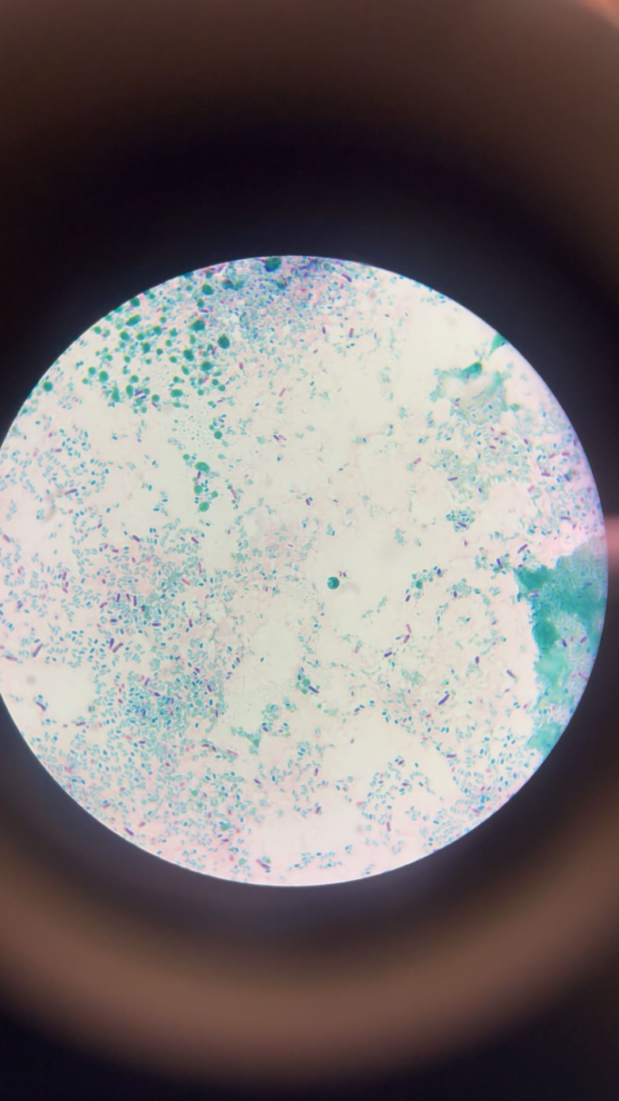 <p>What type of staining was done to this slide? </p>