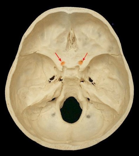 term image