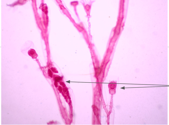 <p>What is this organism? What are the arrows pointing towards? What class and phylum is this part of?</p>