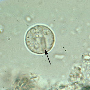 <ul><li><p><strong>cyst form (picture)</strong></p><ul><li><p>contains 1 to 4 nuclei with a central karyosome, cytoplasm may have bars</p></li></ul></li><li><p><strong>trophozoite form</strong></p><ul><li><p>“bullseye” nucleus</p></li><li><p>seen in wet mounts and trichrome stains</p></li></ul></li></ul><p></p>