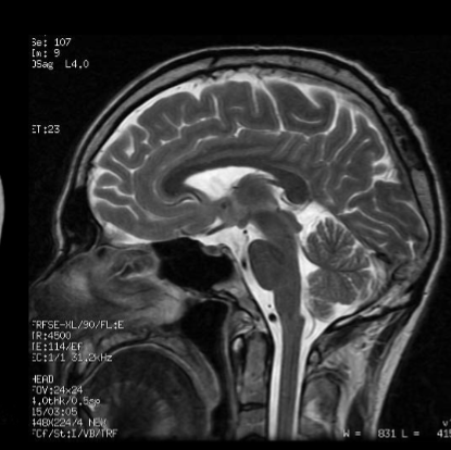 <p>Type of scan, orientation</p>