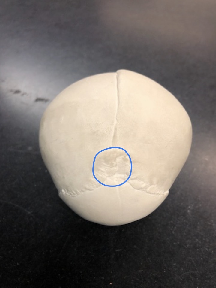 <p>what is this STRUCTURE?</p>