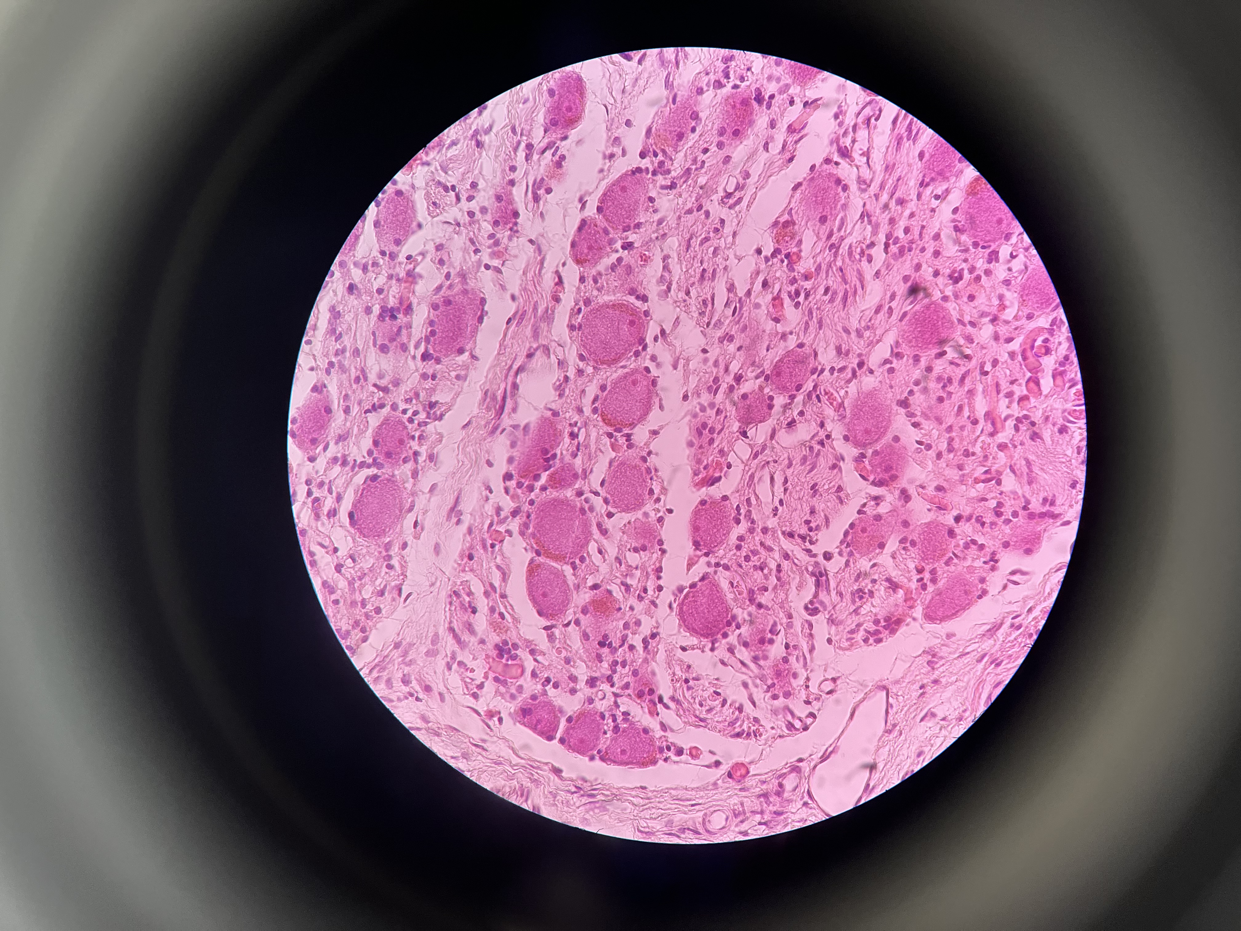 <p>Why do some cells here present without a nucleus?</p>