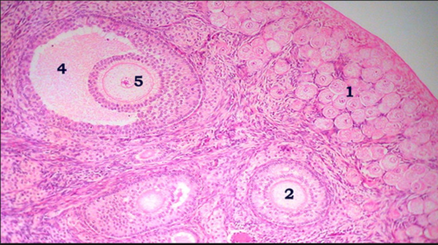 <p>(2) contains small accumulations of fluid in the intracellular space</p>