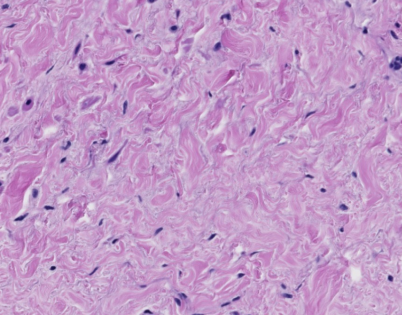 <p>what type of CT is this? be specific.</p>