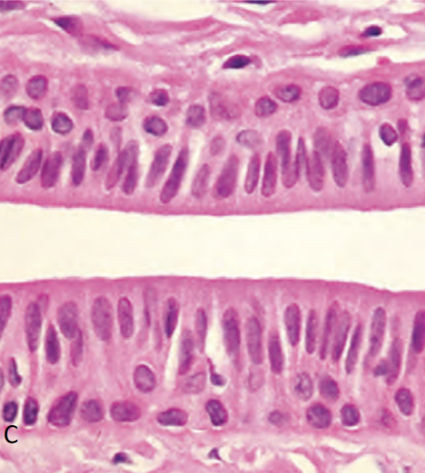 <p>white line in the center</p>