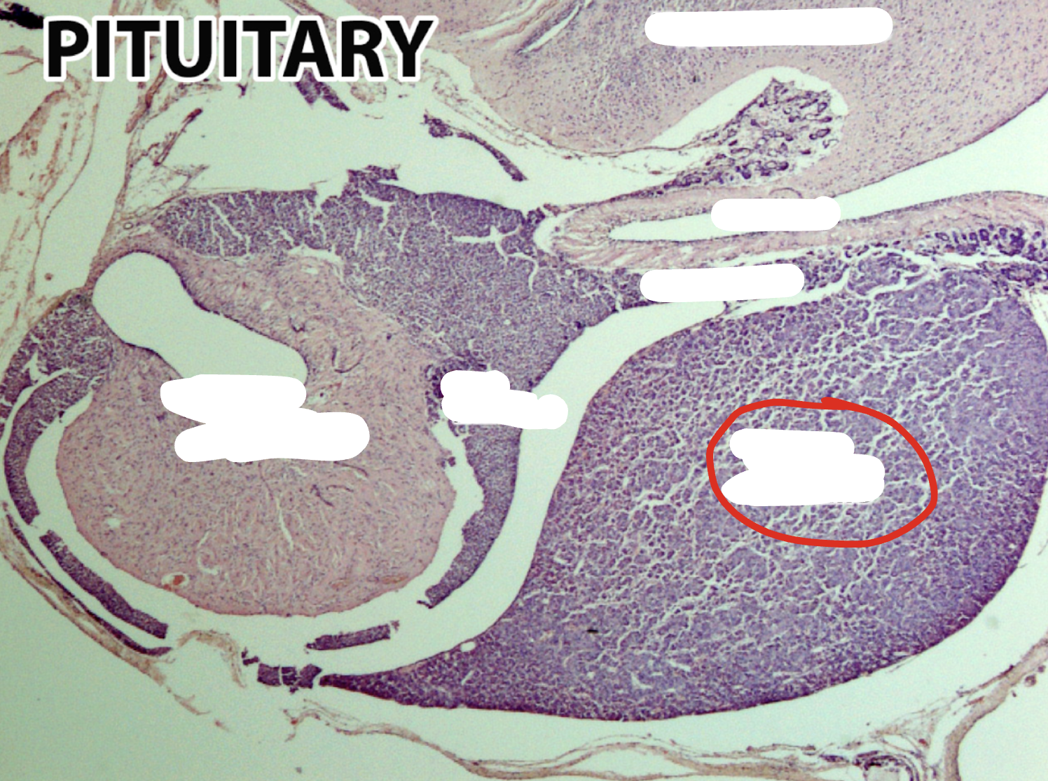 <p>Which part of the pituitary gland is this?</p>