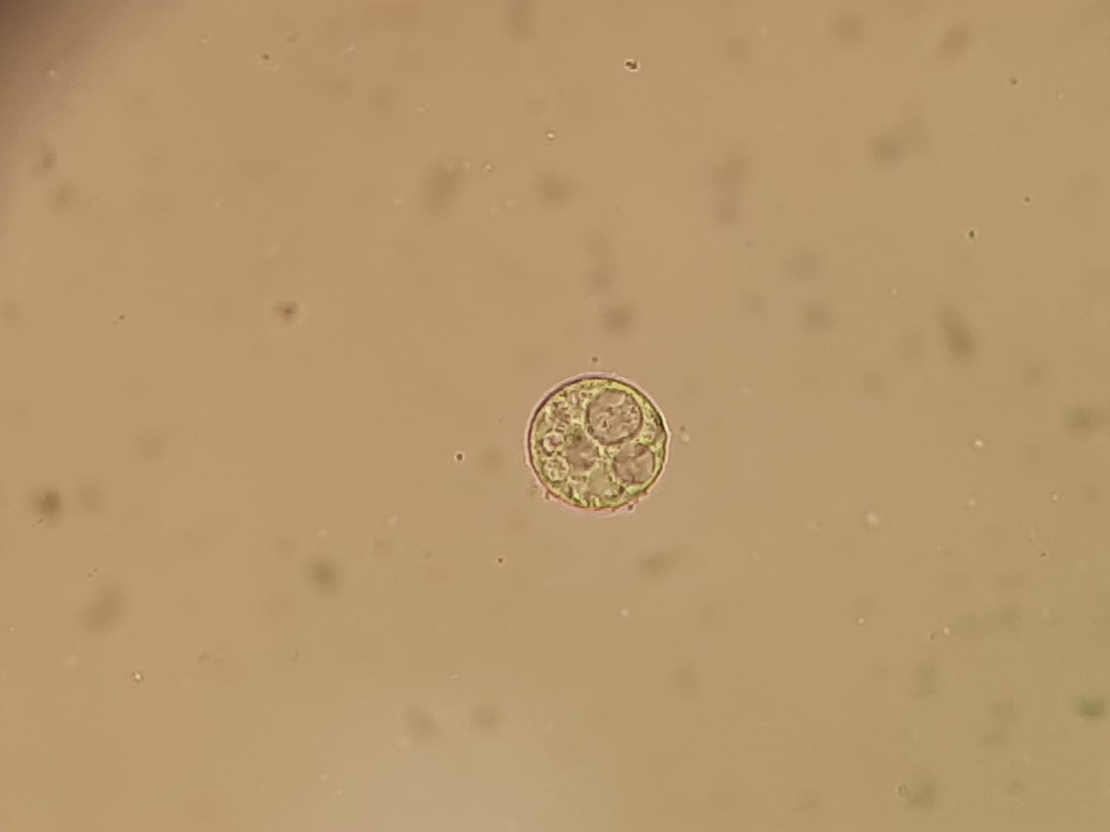 <p>Parasite or Artifact? Identify.</p>