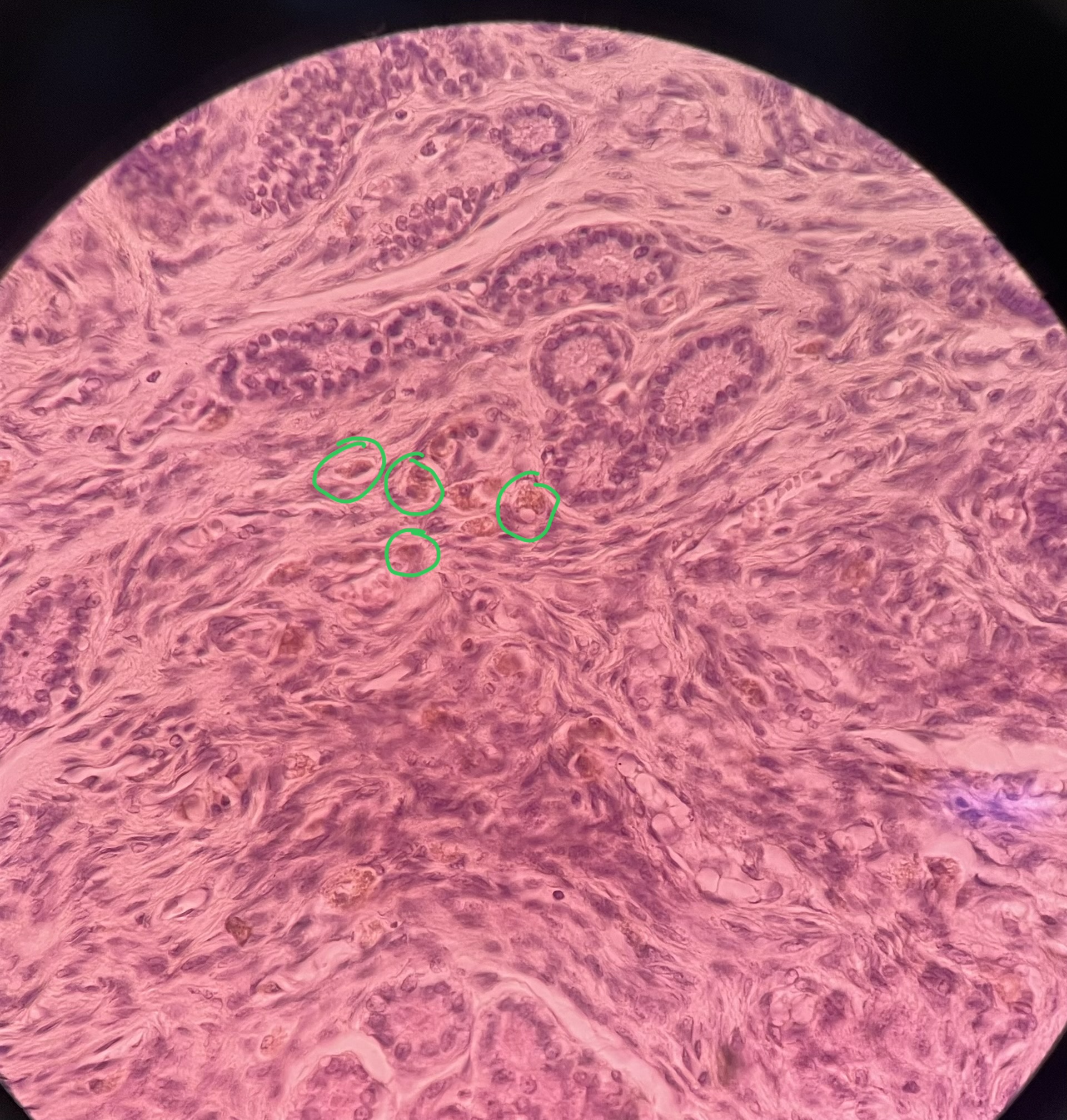 <p>What cell type is circled here?</p>