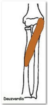 <p>M. Pronator teres</p>