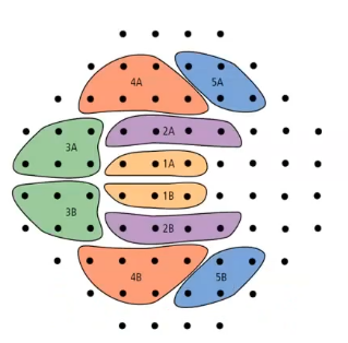 <p>interp VF plot: glaucoma hemifield test GHT</p>