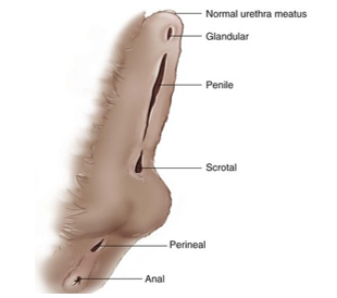 <p><span><strong>29. Disorders of the penis and prepuce – hypospadias, phimosis, paraphimosis</strong></span></p>
