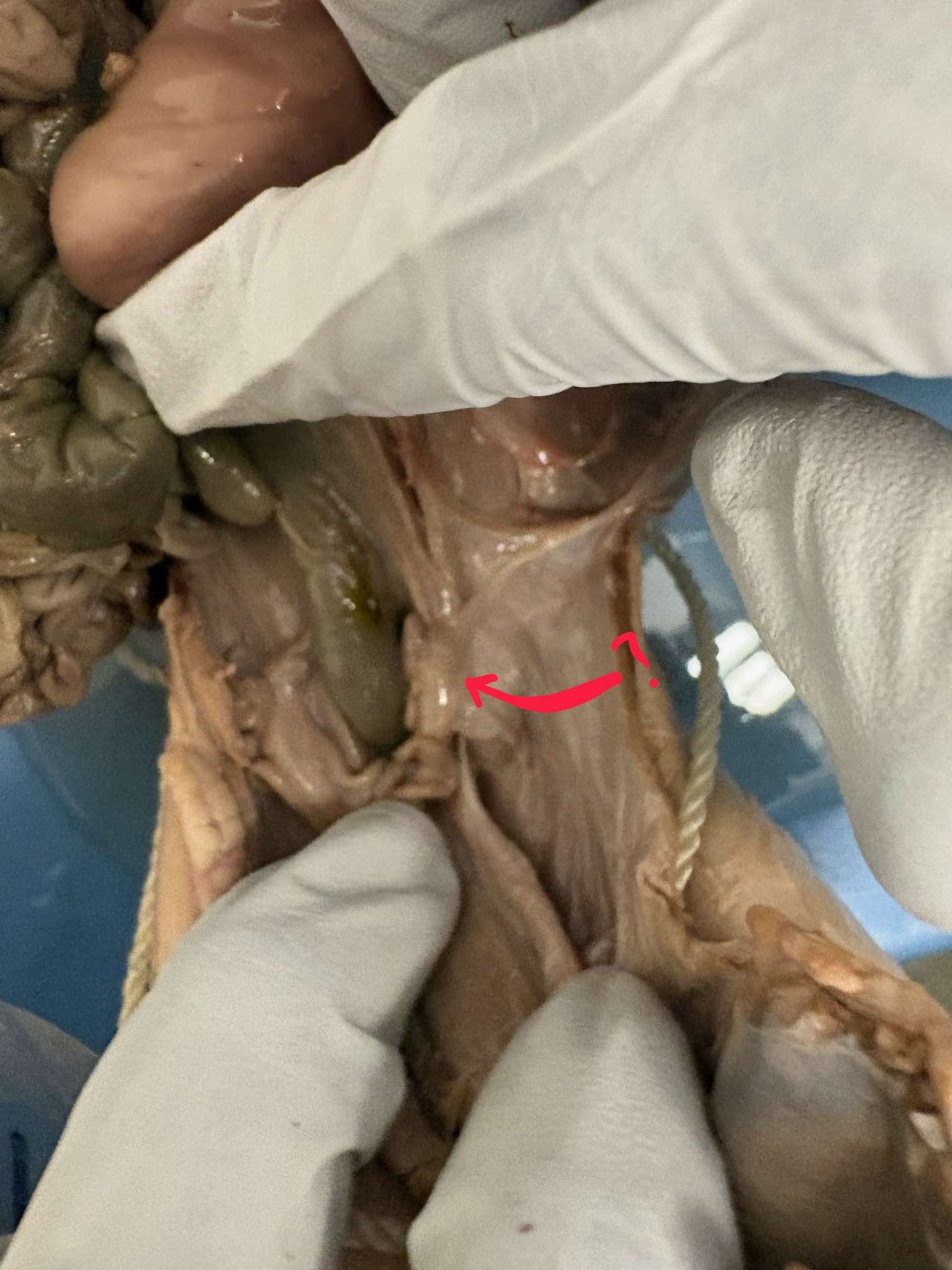 <p>What is the red line pointing to? What is the purpose?</p>