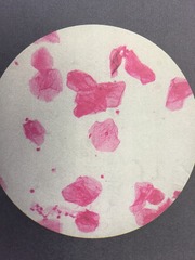 <p>Flat, "fried egg"</p><p>Smear, you can't determine from the appearance if it is simple or stratified. </p><p>This is a smear of stratified squamous epithelium.</p><p>FOUND IN LUNGS, KIDNEYS, SEROUS MEMBRANES</p><p>FUNCTIONS IN OSMOSIS AND SECRETION</p>