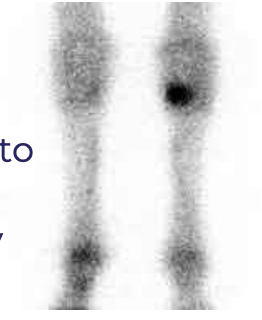 <p>What imaging technique (abbreviated) uses gamma “nuclear” rays to image radioisotopes (Tc) and bone markers injected into the animal? The image shows locations where there has been radiopharmaceutical uptake in bone (hotspots). This allows detection of bone activity changes before radiographs but is not always as specific as it is sensitive. It is indicated when diagnostic analgesia cannot be safely performed, if a fracture is suspected, if the animal is stressed, if there is multiple limb lameness, if there is an axial skeleton problem, and if there is obscure/intermittent lameness or poor performance.</p>