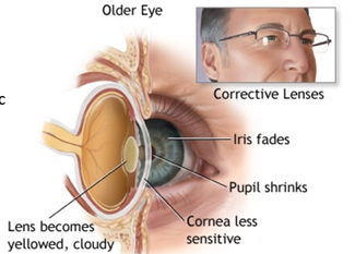 <p>Stiffening of lens, lens becomes denser, yellowing of lens, cell loss in retina and optic nerve<br>Results in presbyopia, need for brighter light, changes in colour perception<br>Disorders (secondary aging) - cataracts, macular degeneration, glaucoma</p>