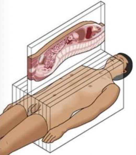 <p>what does this image show?</p>