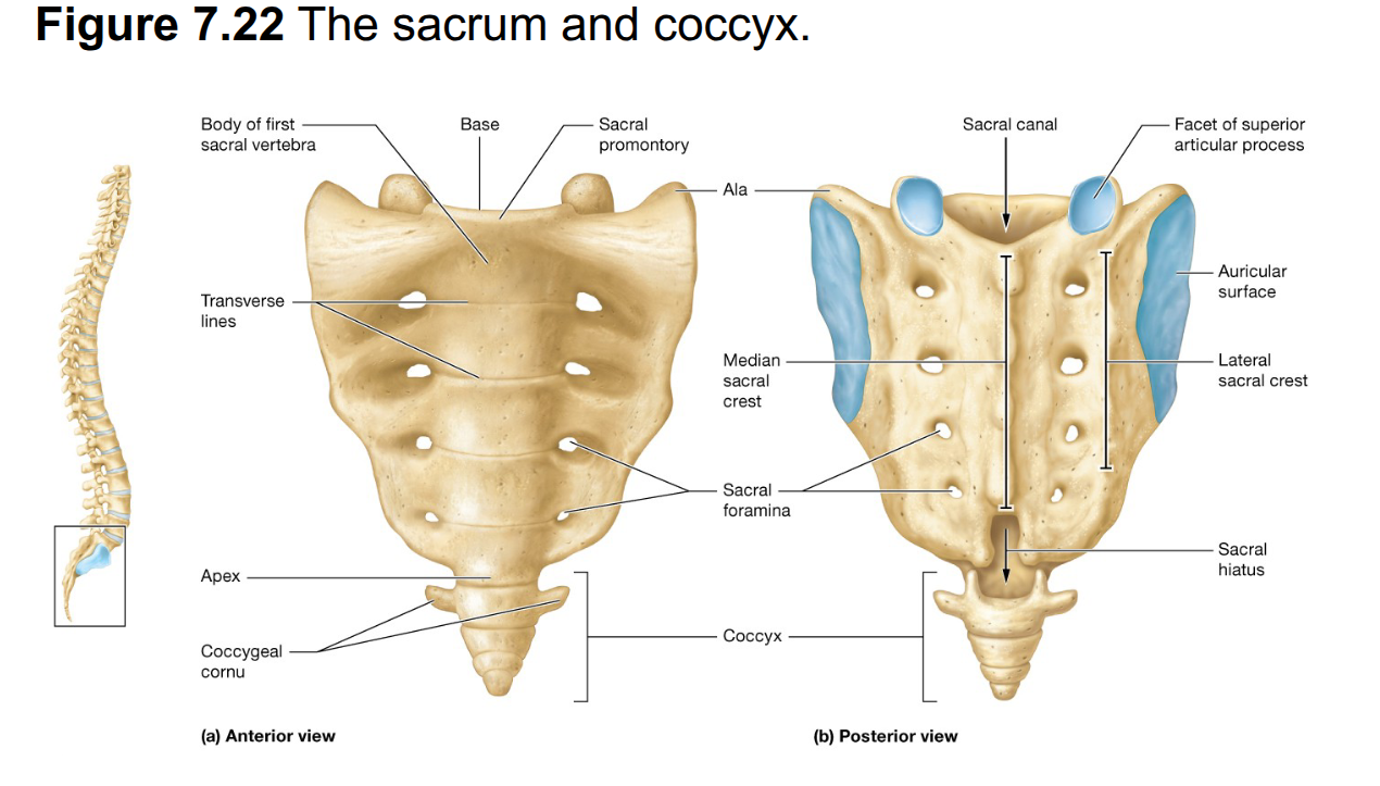 <p>S1-S5 form the posterior wall of the pelvic cavity; </p><p>Fuse by ages 20–25 </p><p>Flattened <strong>Base</strong> on superior surface articulates with 5L at its superior articular processes</p><p><strong>Apex</strong> at the inferior surface articulates with the coccyx</p><p><strong>Auricular Surfaces</strong> on the lateral sides articulate with the pelvic bones</p><p><strong>Sacral Promontory</strong> is a bony projection at the anterior margin of the base with smooth regions called <strong>Alae</strong> </p><p><strong>Sacral Canal </strong>opening connects to the vertebral canal and terminates in the <strong>Sacral Hiatus</strong></p><p>Bordered posteriorly by the <strong>Median Sacral Crest</strong> with 4 pairs of holes called the <strong>Sacral Foramina</strong></p><p>Lateral to these are the <strong>Lateral Sacral Crests</strong></p>