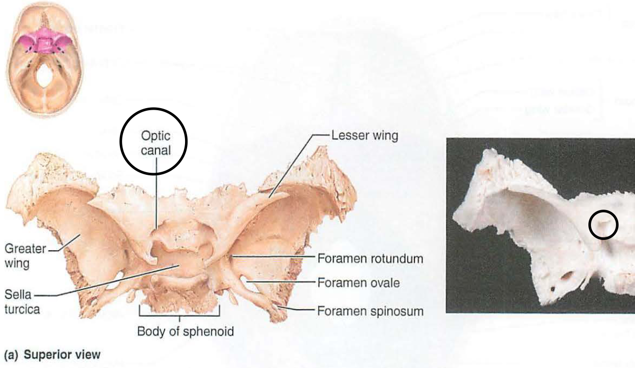 <p>vii. optic canal</p>