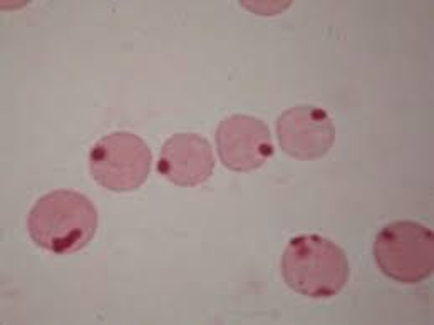 <p>G6PD deficiency, unstable hemoglobin causing iron to be unprotected, oxidizing drugs, alpha thalassemia</p>