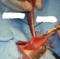<p>What is the right arrow pointing to?</p>