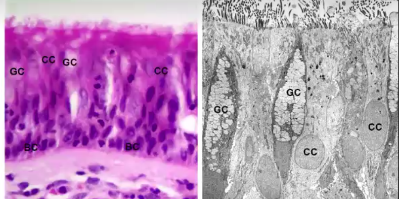 <p>large amount of lipids in muscus means they will stain very light or not at all.</p><ul><li><p>non-cilliated</p></li><li><p>connect with basal lamina and apical site</p></li><li><p>more numerous during chronic irritation</p></li><li><p>mucus is composed of glycoproteins MUC5AC and MUC5B</p></li></ul><p></p>