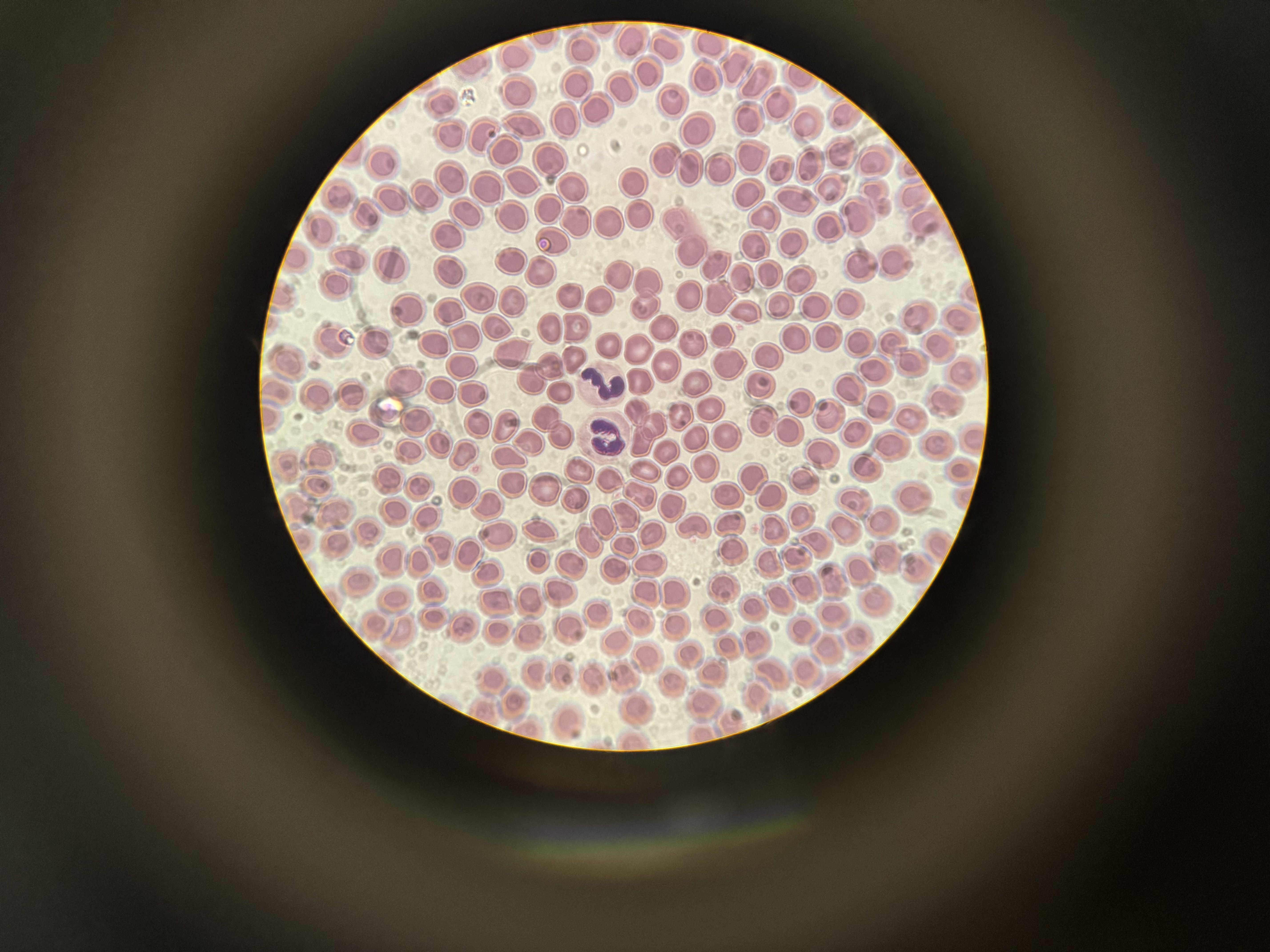 <p>a) Which WBC is this?</p><p>b) Describe the nucleus.</p><p>c) Size?</p><p>d) Function?</p><p>e) What does it become?</p>