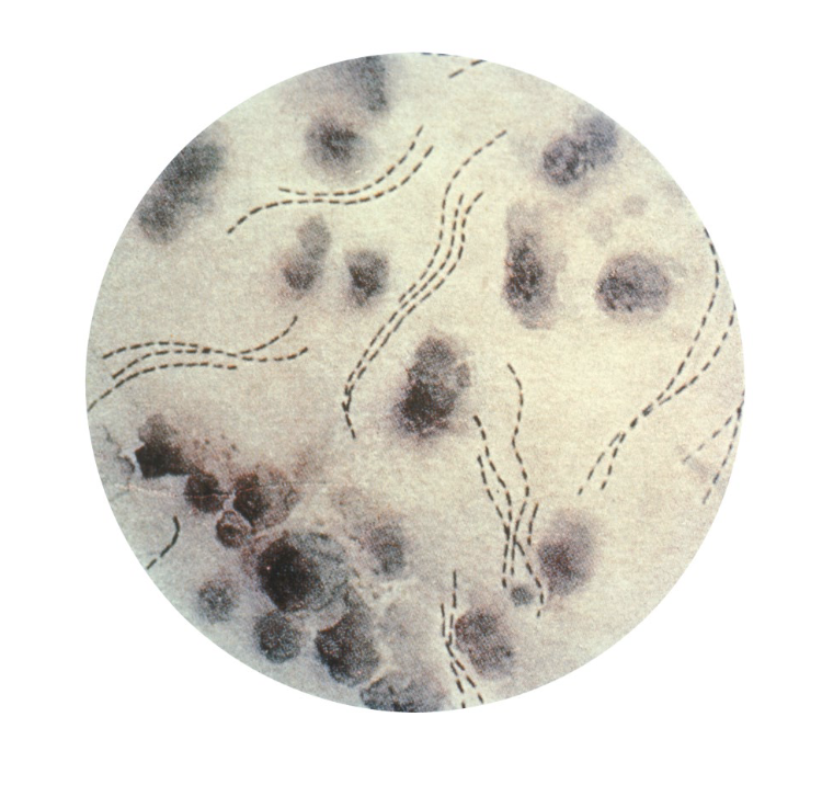 <p>what bacteria’s gram stain and colonies characteristics best fit the following information:</p><ul><li><p>colony: dome shaped and adherent</p></li><li><p>gram stain: groups of GNR</p><ul><li><p>“<strong>school of fish</strong>” or “<strong>railroad tracks</strong>”</p></li></ul></li></ul><p></p>