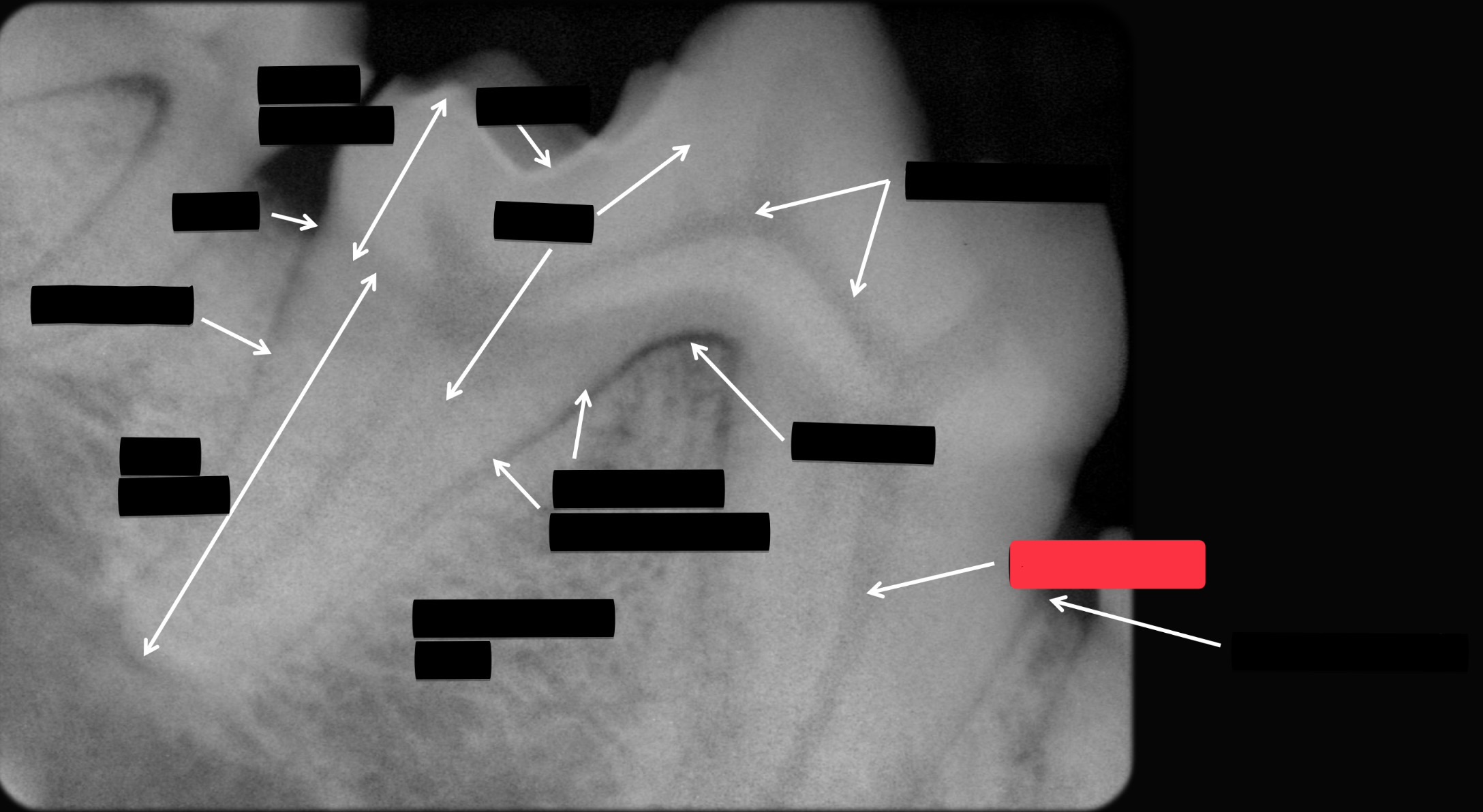 <p>Label this part of the tooth.</p>