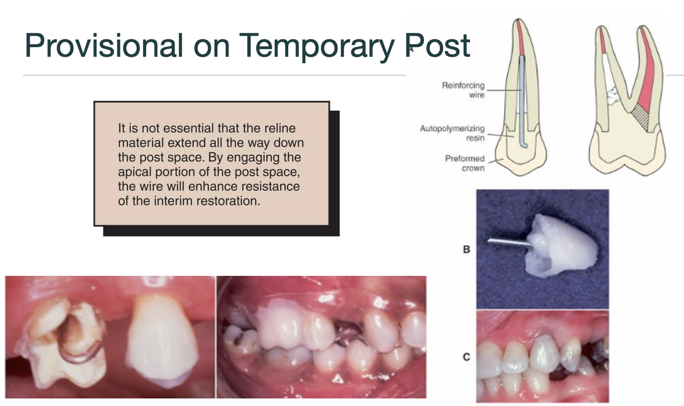 <p>no → by engaging the apical portion of the post space, the wire will enhance resistance of the interim restoration </p>