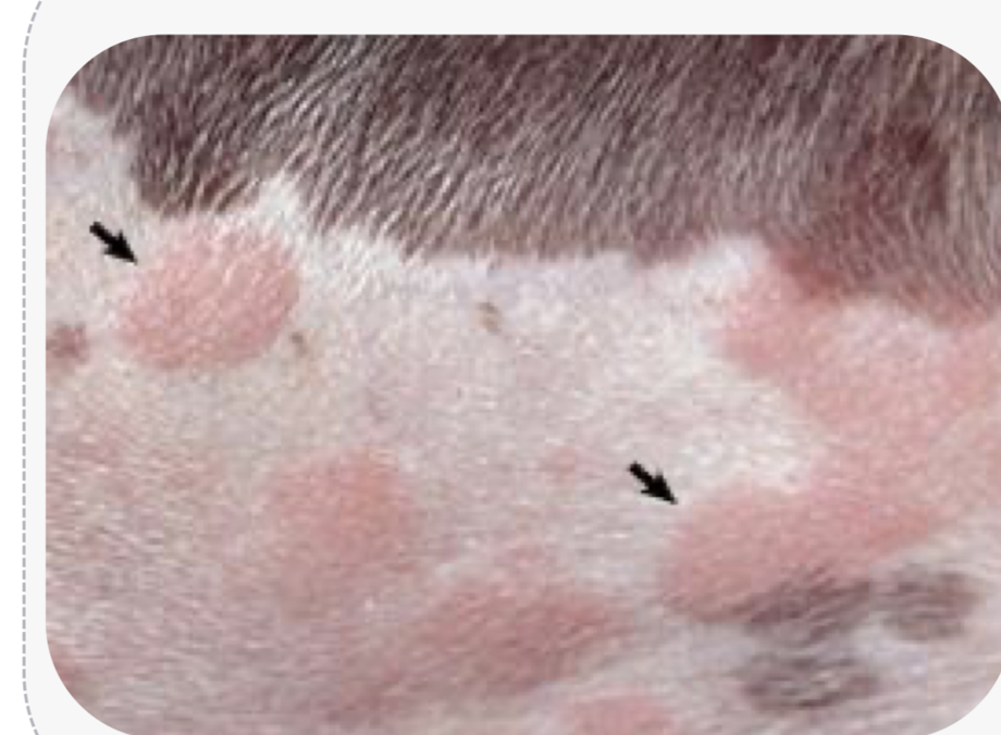 <p>What primary lesion is this? </p>