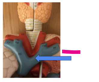 <p>What is the pink arrow?</p>