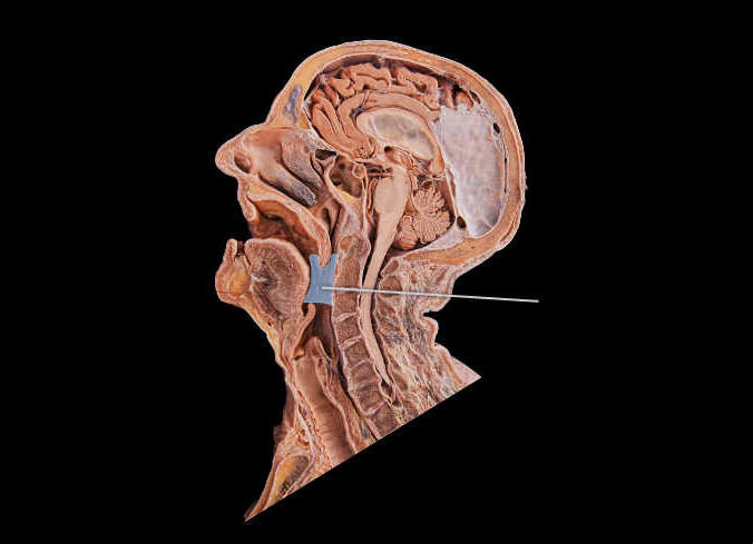 <p><span>Identify the highlighted respiratory structure (midsagittal view).</span></p><p> </p><p>nasopharynx</p><p> </p><p>oropharynx</p><p> </p><p>laryngopharynx</p><p> </p><p>trachea</p>