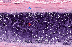 <p>What is the outer covering around cartilage called as indicated by "A"?</p>