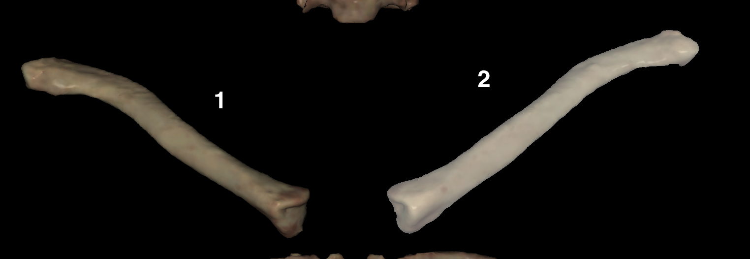 <p>Which is the <strong>right</strong> clavicle?</p>