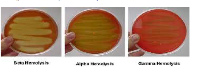 <p>Blood agar is differential </p><p>Blood Agar (TSA + 5% sheep red blood cells) is an <strong>enriched and differential</strong> medium. It provides rich nutrients for fastidious microbes and differentiates bacteria based on the production of <strong>hemolysins</strong>; enzymes that lyse red blood cells (RBCs) and break down hemoglobin:</p><ul><li><p><strong>Beta Hemolysis:</strong> Complete lysis of red blood cells and digestion of hemoglobin. Appears as a <strong>clear, transparent halo</strong> around the bacterial growth.</p></li><li><p><strong>Alpha Hemolysis:</strong> Partial breakdown of red blood cells and oxidation of hemoglobin. Produces a <strong>greenish-brown discoloration</strong> surrounding the colonies.</p></li><li><p><strong>Gamma Hemolysis:</strong> No hemolysis. The bacteria grow normally, producing <strong>no change in color or clarity</strong> in the surrounding red agar.</p></li></ul><p></p>