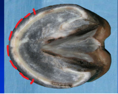 <p>What is the clinical significance of the toe?</p>