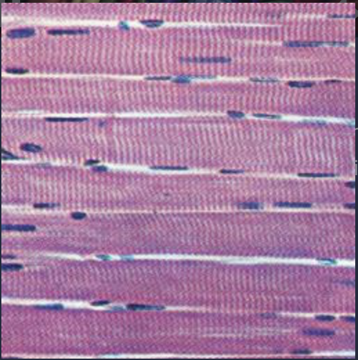 <p><span>- flexible muscle fibers</span><br><span>- long, cylindrical, striated</span></p>