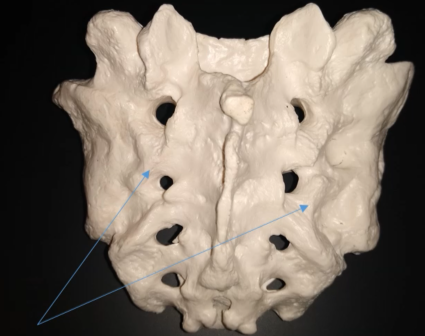 <p>What are these ridges?</p>