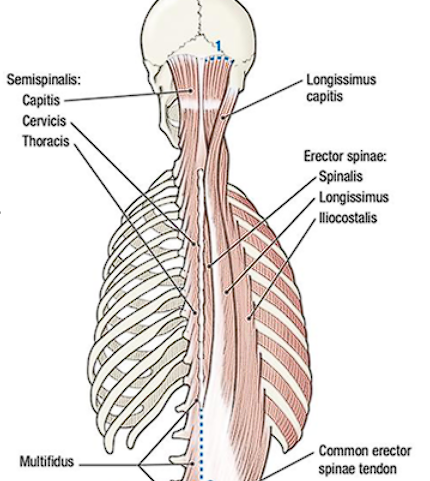 <p>From lateral to medial:<span> </span><span style="color: red;">Iliocostalis, Longissimus, Spinalis</span></p>
