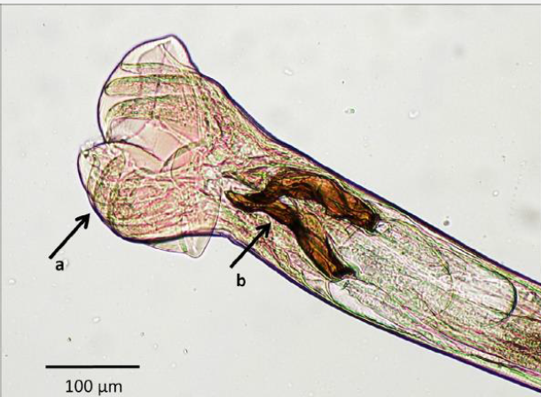<p>Name this Threadworm</p>