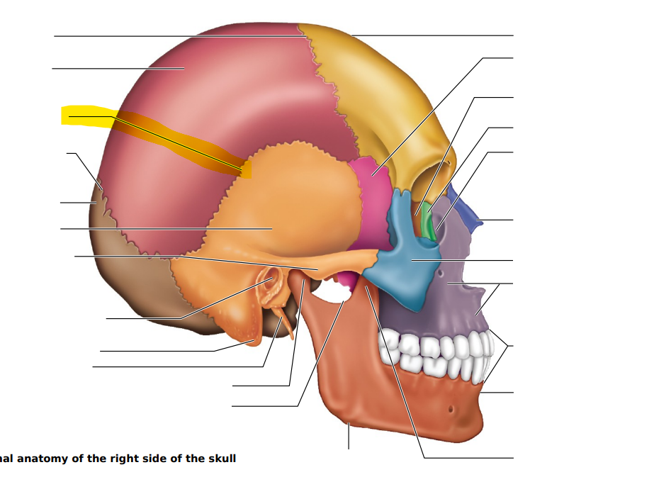 term image
